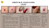 erkes_ir_ju_sukeliamos_ligos.jpg